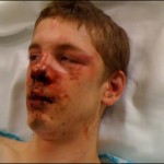 White teen tortured and beaten by blacks 