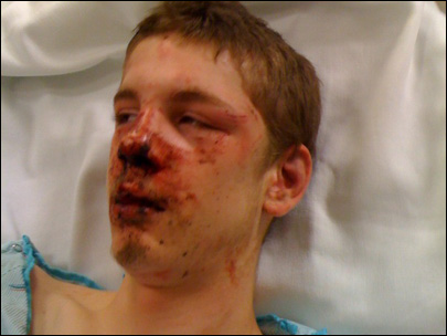 White teen tortured and beaten by blacks
